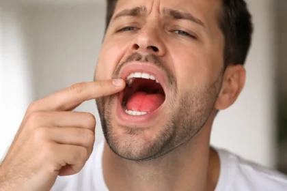 Why Does the Roof of My Mouth Hurt with common causes of palate pain and relief tips